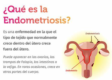 endometriosis